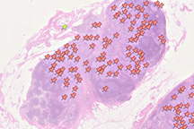Lymph node