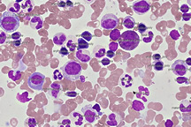 Bone marrow